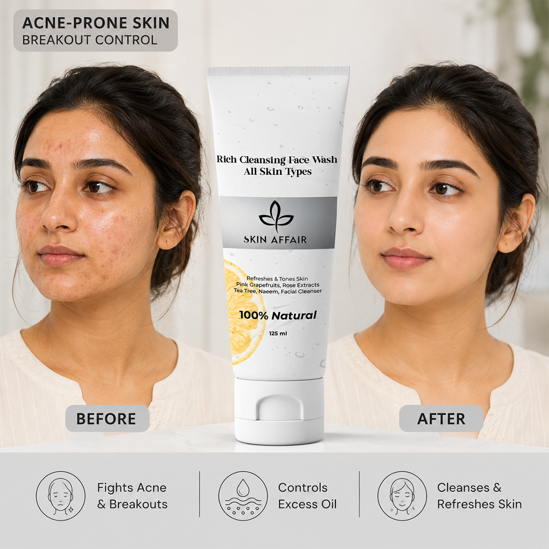Acne-Clear Face Wash